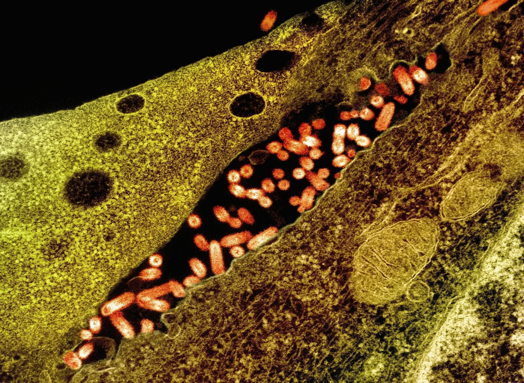 Fighting Biofilms with Foods, Nutraceuticals, Supplements, Herbs, and Protocols - Lemongrass Farms