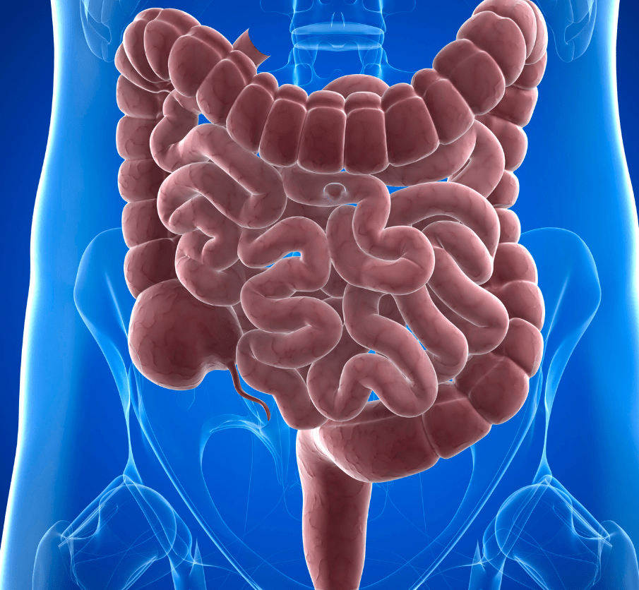 Leaky Gut: What It Is and How to Heal It - Lemongrass Farms